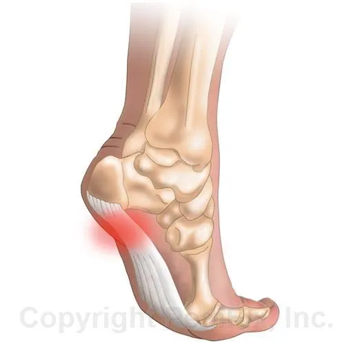 Plantar Fasciitis Relief Strips